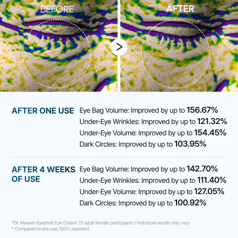 Aloria Eyephalt Eye Cream