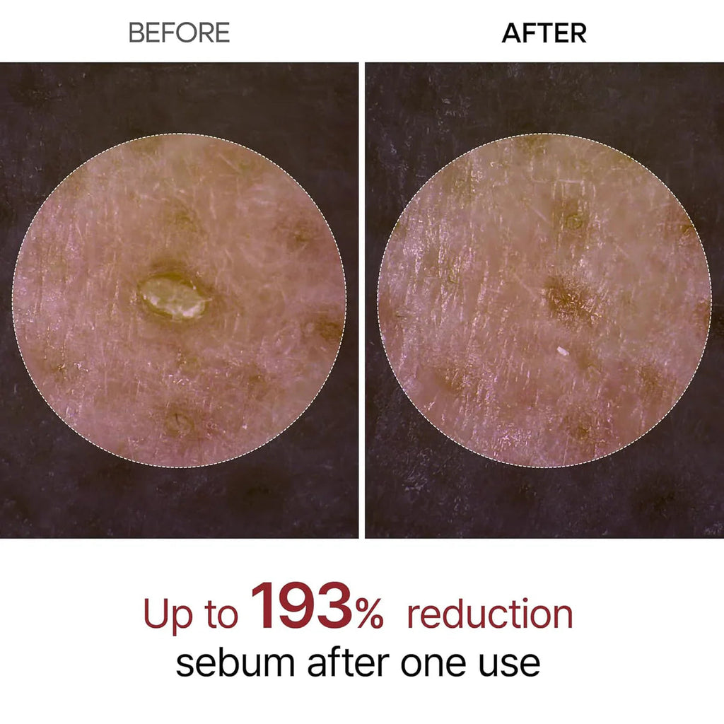 Aloria Rice Peel Serum Ampoule™