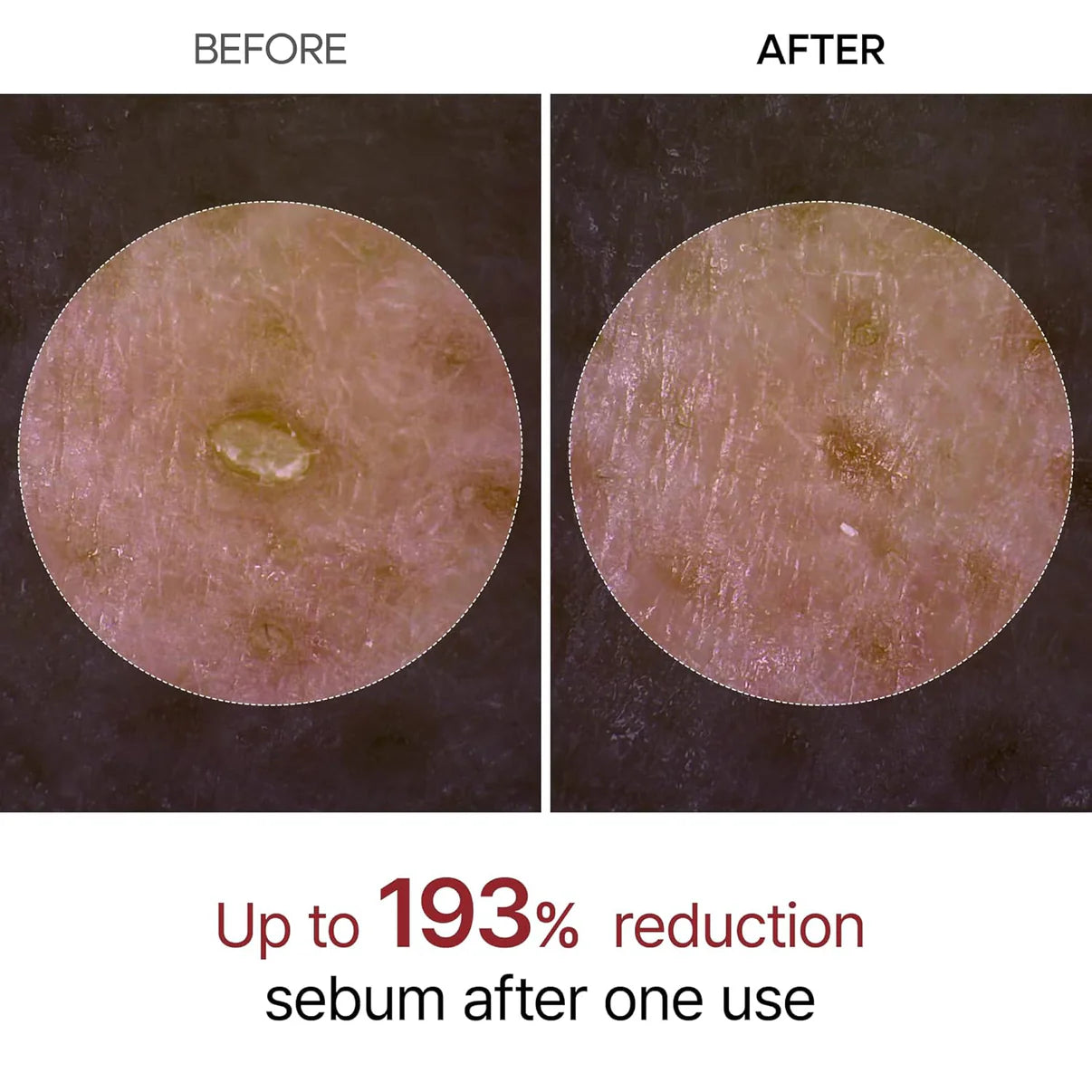 Aloria Rice Peel Serum Ampoule™